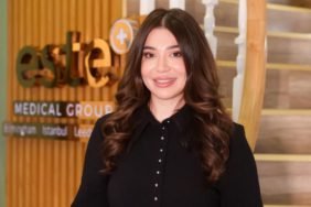 Este-Medical-Group8217tan-Kadinlara-Ozel-Tirassiz-Sac-Ekimi-Cozumu-featured