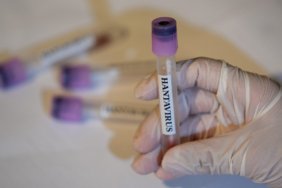 AB8217den-Hantavirus-Riski-Tasiyan-Gemide-Tahliye-featured