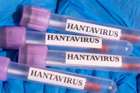 DSO-Hantavirus-Gemi-Vakasi-Kuresel-Risk-Tasimiyor-featured