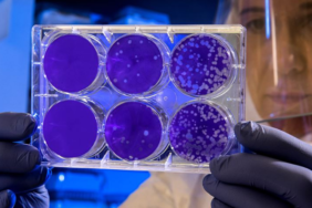 Hantavirus-Gemide-Olum-Yaratti-Bulasma-Yollari-ve-Belirtileri-featured
