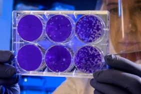 Hantavirus-Panigi-12-Hastane-Personeli-Karantinada-featured