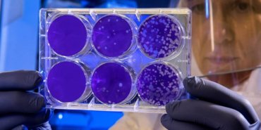 Hantavirus-Panigi-12-Hastane-Personeli-Karantinada-featured