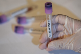 Hantavirus-Turkiye039de-goruldu-mu-vaka-sayisi-kac-oldu-Hantavirus-insandan-bulasir-mi-oldurur-mu-featured