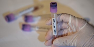 Hantavirus-Vakalari-ABD-ve-Fransa8217da-Yeni-Vaka-Haberleri-featured