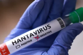 DSO-Hantavirus-Salginini-Sona-Erdirdi-Vaka-Yok-featured