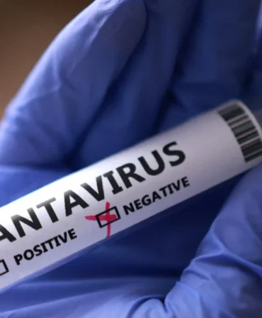 DSO-Hantavirus-Salginini-Sona-Erdirdi-Vaka-Yok-featured
