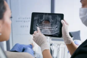 Dolgu-ve-implant-donemi-bitiyor-mu-Kok-hucreyle-canli-dis-donemi-featured