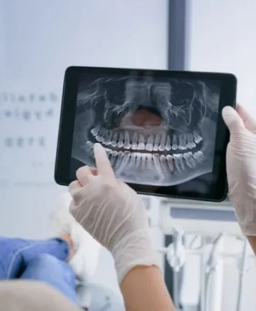 Dolgu-ve-implant-donemi-bitiyor-mu-Kok-hucreyle-canli-dis-donemi-featured