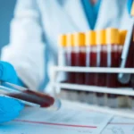 Kolon kanseri taraması için geliştirilen kan testine FDA'dan onay 11 Kolon-kanseri-taramasi-icin-gelistirilen-kan-testine-FDA039dan-onay-featured