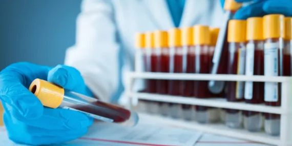 Kolon kanseri taraması için geliştirilen kan testine FDA'dan onay