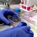 Ingiltere8217de-Salmonella-Panigi-207-Vaka-Tespit-Edildi-featured