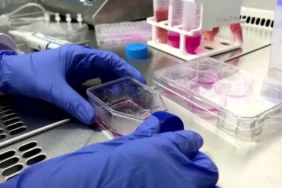 Ingiltere8217de-Salmonella-Panigi-207-Vaka-Tespit-Edildi-featured