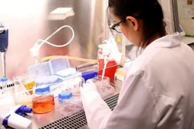 Pankreas Kanseri Tedavisinde Yeni Umut: FDA Yeni İlacı Onayladı 3 Pankreas-Kanseri-Tedavisinde-Yeni-Umut-FDA-Yeni-Ilaci-Onayladi-featured